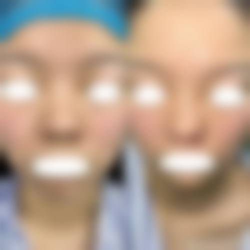 十六、郑州颐和医院整形科患者常见问答