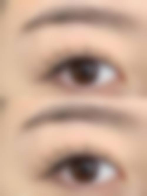 八、种植头发医院医生如何选择