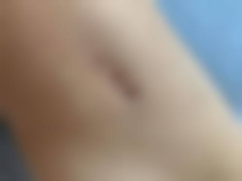 1、主要做的三大诊疗项目