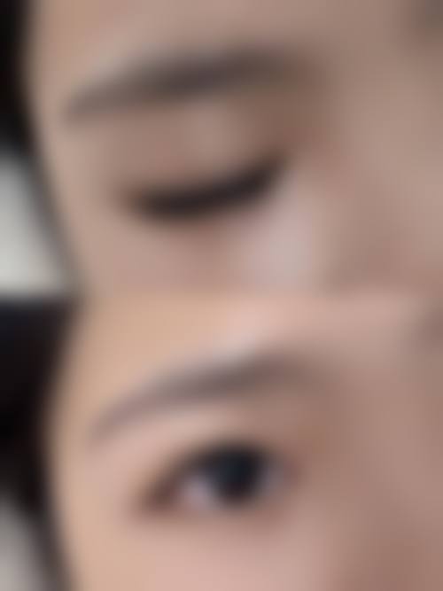 大连京城植发医院特色诊疗项目