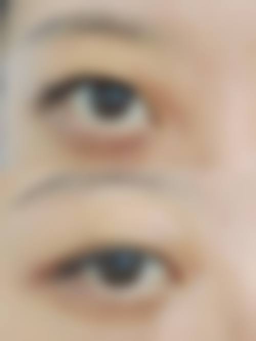 大连京城植发医院患者常见问题解答（精选）