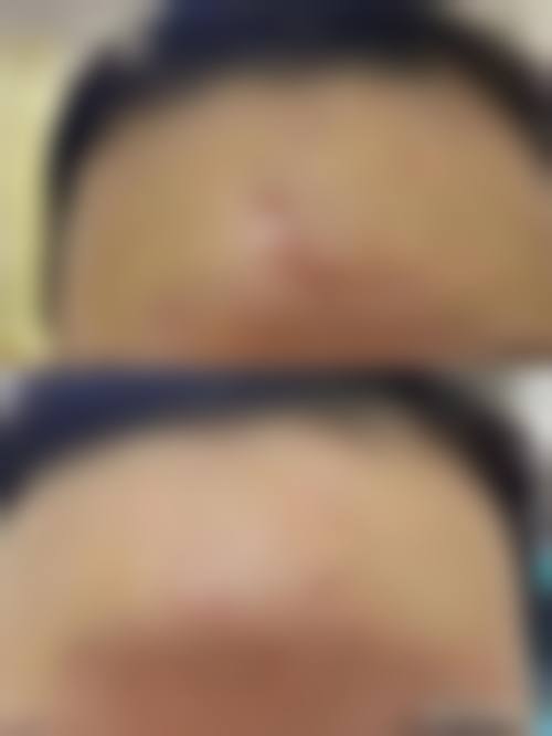 2、【快速祛皱】核心技术优势