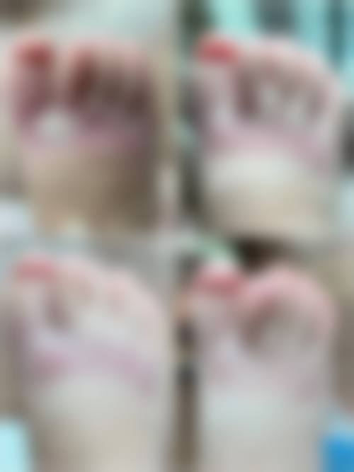 六、疤痕疙瘩治疗的价格参考