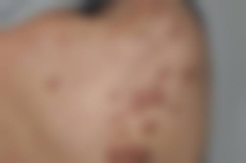 十一、复旦大学附属华 山医院整形外科预约挂号