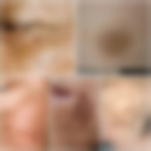 {疤痕疙瘩到底能不能治，能彻底修复吗？规范治疗复发率可低至5%-10%