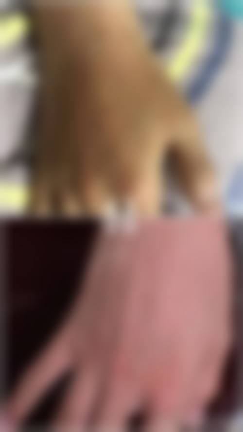 七、不同治疗方式适合的人群