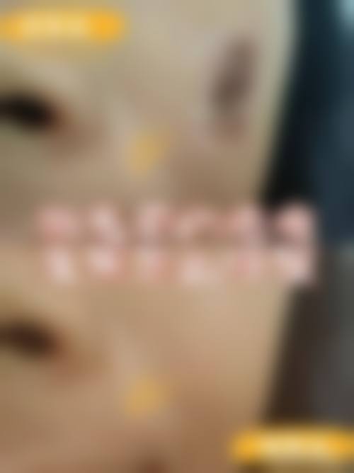 七、长沙妍阡整形医院口碑如何