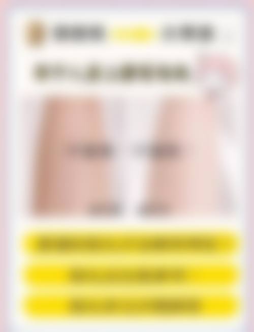 七、哪些人适合做临沂星塑美激光脱毛？如何避免踩坑