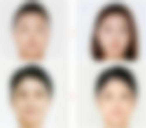 四、河北医 科 大学第三医院谈打瘦脸针不对称危害