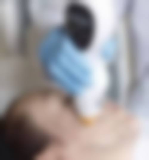 临沂星塑美四代热玛吉900发项目价格贵吗？