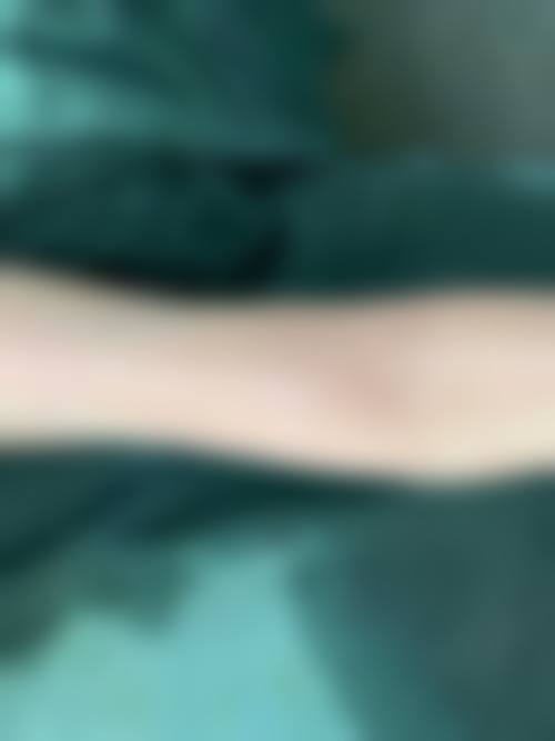 手臂抽脂医院医生如何选择