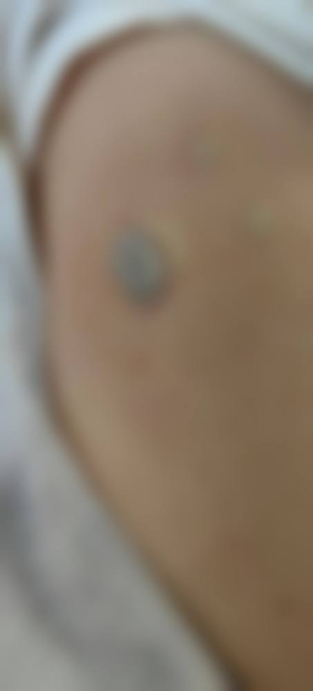 六安瑞妍美整形医院正规靠谱吗？卫健委正规资质查询：