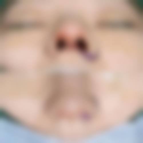 3. 面诊全程无套路，张院长的方案精细解决我的问题