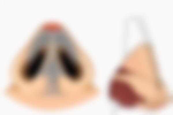 八、韩国瘦脸 + 下颌缘避坑指南