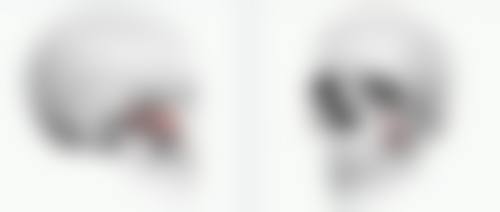 五、揭秘肉毒素与玻尿酸的真实成分，安心除皱要点！