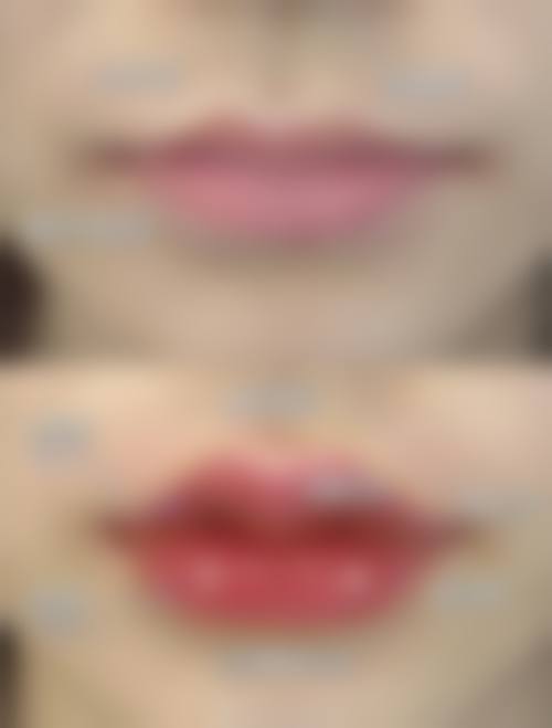 九、杭州芯美昕医疗美容机构收费价格表