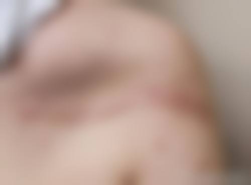 德州韩的式医疗美容诊所温馨提示