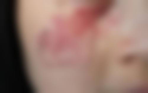 二、杭州芯美昕医疗美容机构怎么样