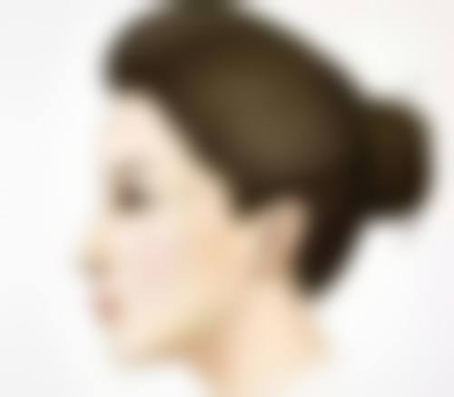 三、无痕筋膜提升能维持多久？