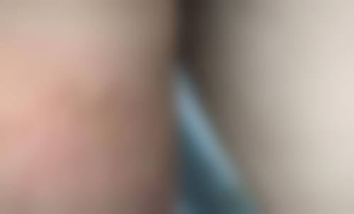 七、台州新凤凰医学整形美容医院价格表