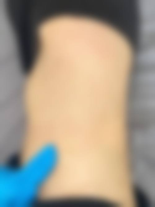 泸州悦她婕熹卡整形医院特色技术优势及特色技术服务