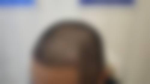 莱州明媛整形医院正规靠谱吗？卫健委正规资质查询：