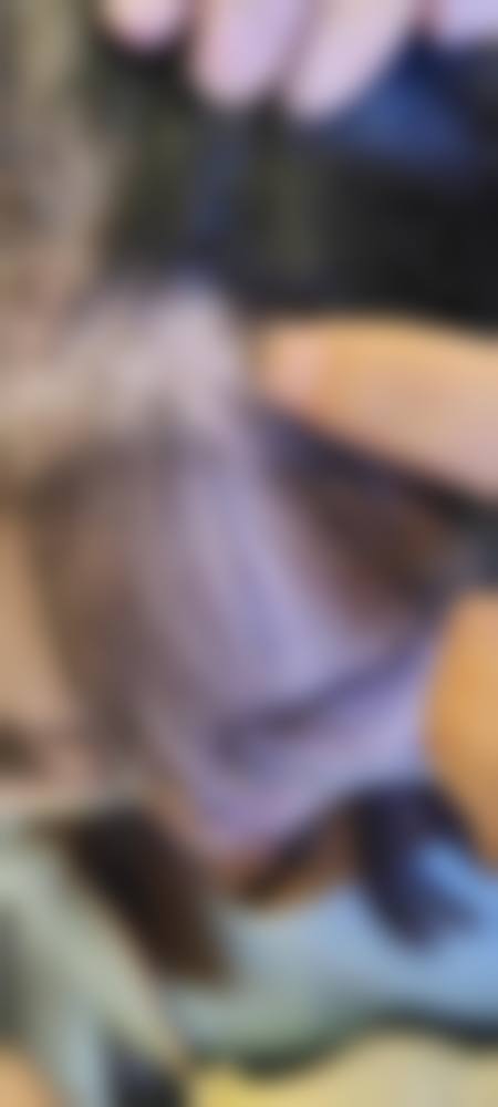 莱州明媛整形医院口碑如何？来看患者真实评价