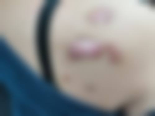 5、大理余衡整形外科医院口碑好评反馈