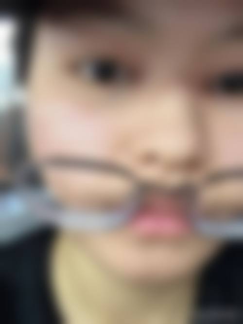六、按摩消除眼袋的成效