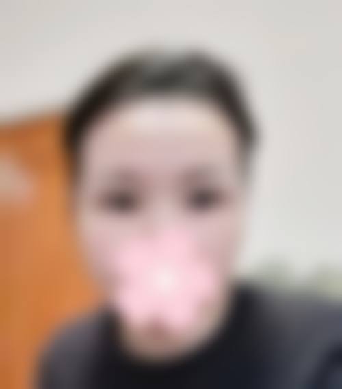 七、按摩消除眼袋的适合人群