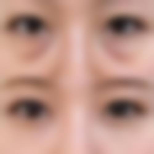 有眼袋按摩哪些穴位？其实【中医科主任】早说了，因为眼袋重按摩哪个穴位和消除眼袋按摩手法都对，但根源在脾胃。