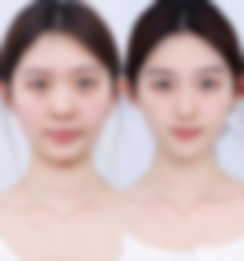 四、温州鹿城芙莱拉医疗美容门诊部正规靠谱吗
