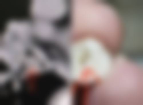 五、沈阳罗晶医疗美容诊所真实实例参考