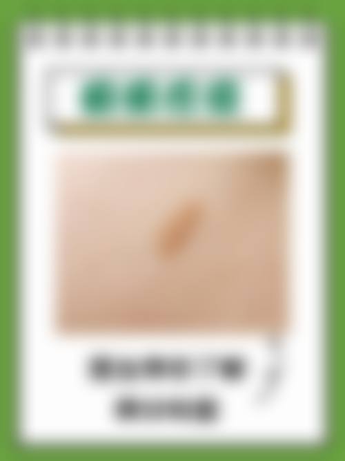 六、有疤痕疙瘩怎么去掉?找【三等甲骨干医生】在线拆解方案(24h接诊)