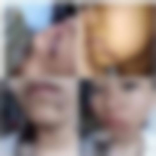 清潭梅勒皮肤科医院主要特色项目