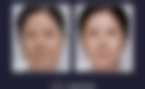 余辉
