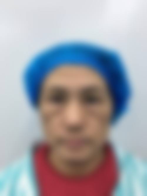 五、黑眼圈还有眼袋的解决方案