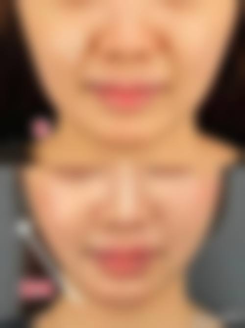 五、大同修形美林医疗美容门诊部真实实例参考