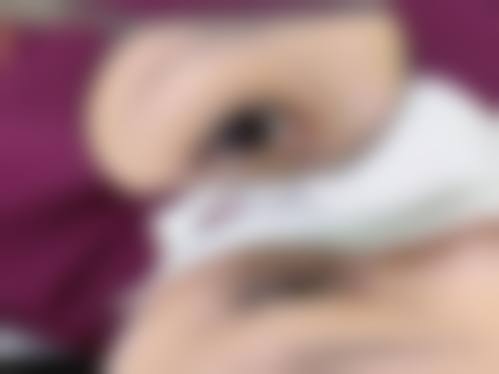 二、刘煜阳医生擅长项目