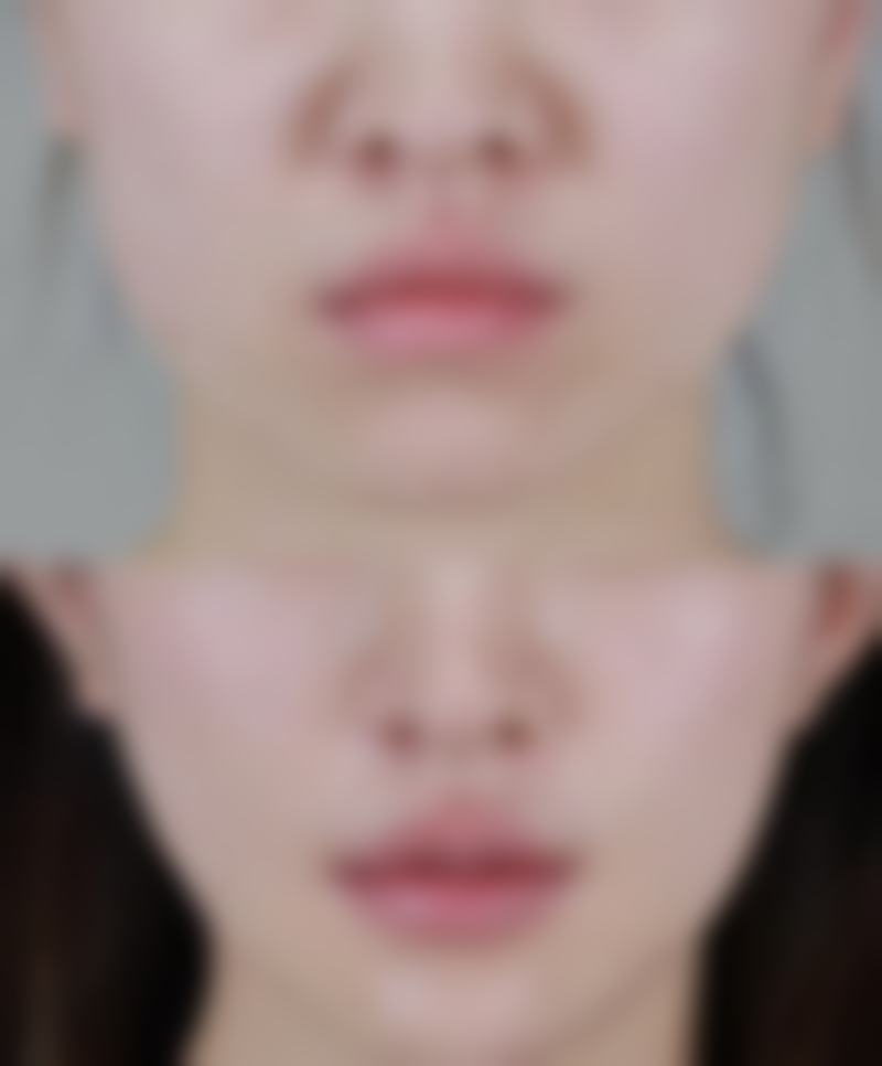 北京卓颜蕊丽医疗美容（原知音蕊丽）患者常见问题解答（精选 ）