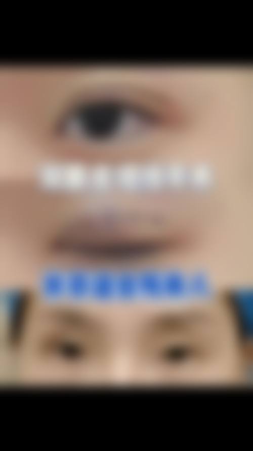 七、郑州荣美会医疗美容诊所常见问题解答