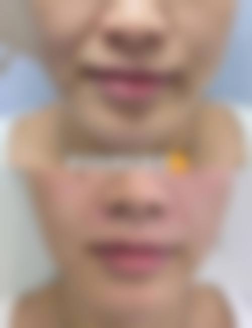 九、哈尔滨蜜柚医疗美容医院口碑与评价