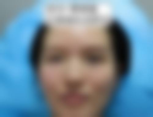 一、哈尔滨蜜柚医疗美容医院怎么样?是专注面部微整形的新锐医美专科医院