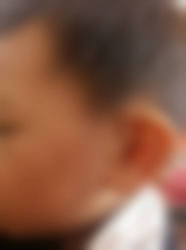 1、主要做的三大诊疗项目