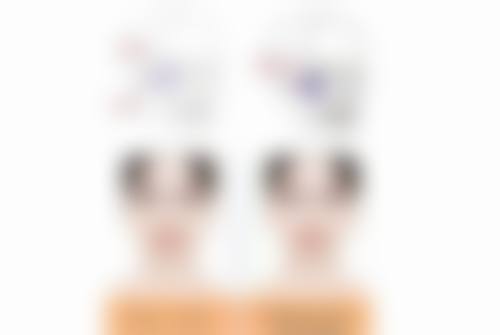 韓國NANA鼻修復評價:港澳姊妹真實实例對比