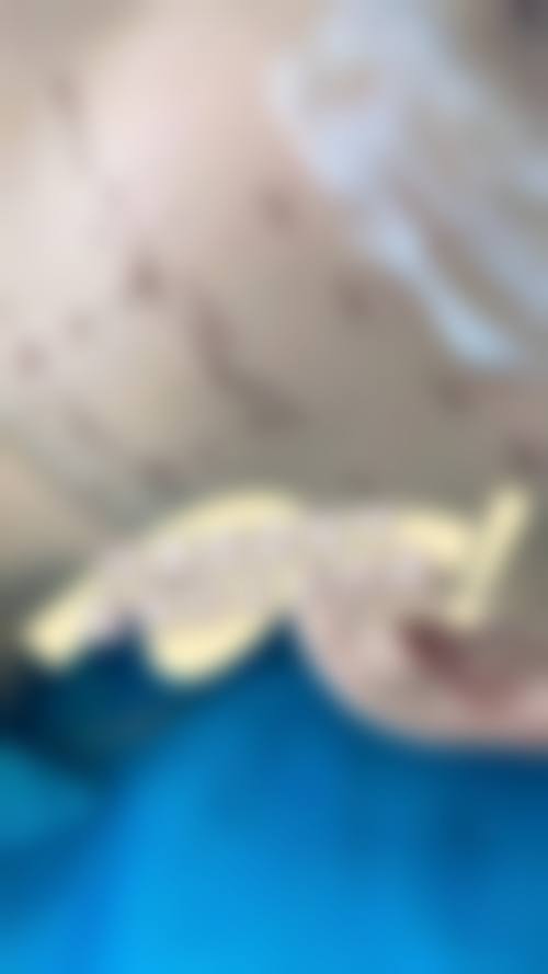 拓展延伸：韓國埋線拉提項目真相+關鍵選擇點