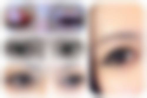 八、眼皮松做双眼皮的避坑 + 实操建议