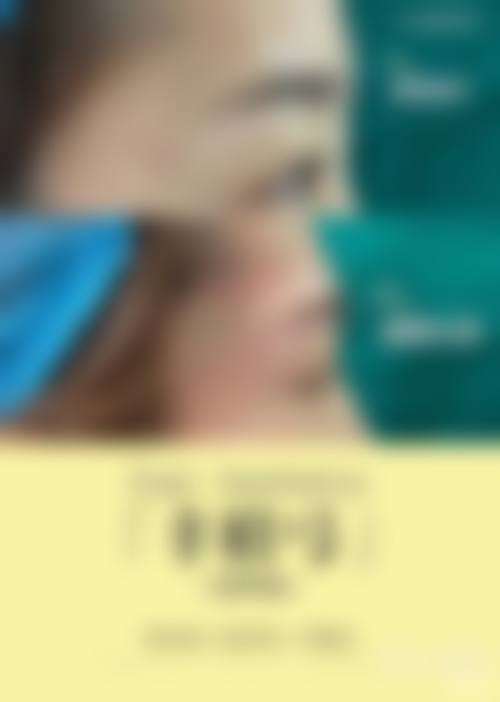 五、割完双眼皮后抽烟的处理方法