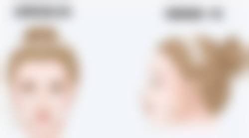港澳姊妹必讀:私密醫美項目真相大公開