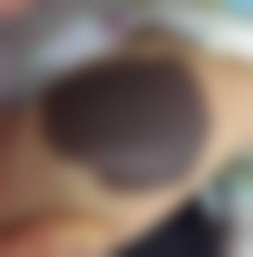 济南星范医疗美容医院正规可靠吗？